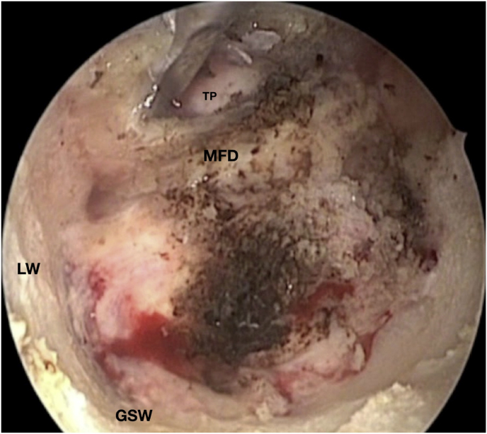 Fig. 3