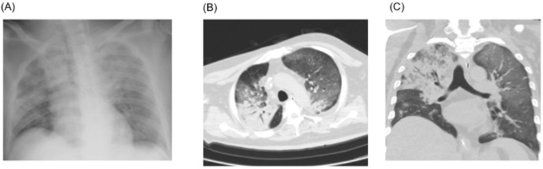 Fig. 3