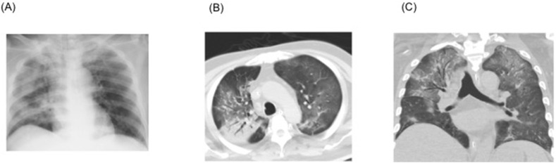 Fig. 4