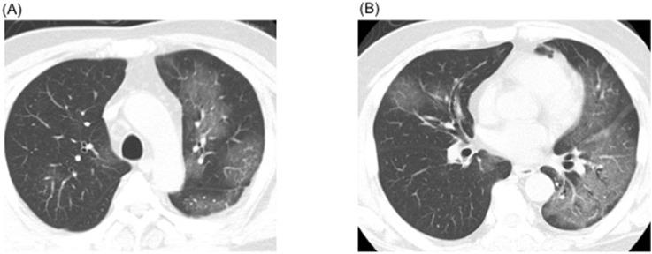 Fig. 1