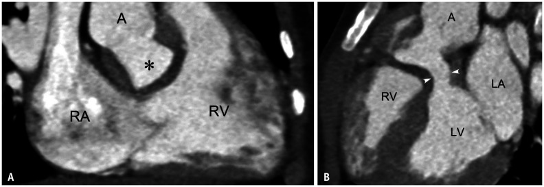 Fig. 20