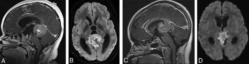 Fig 3.