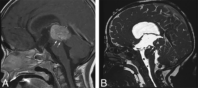 Fig 4.