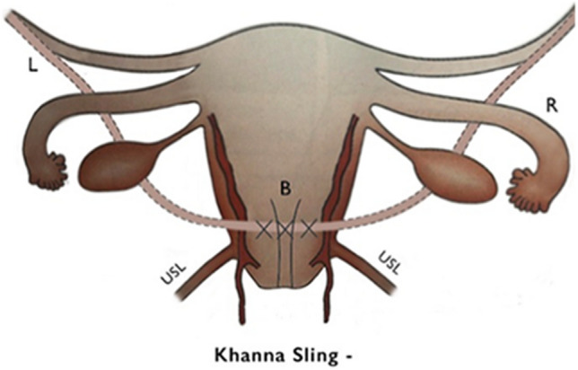 Fig. 5