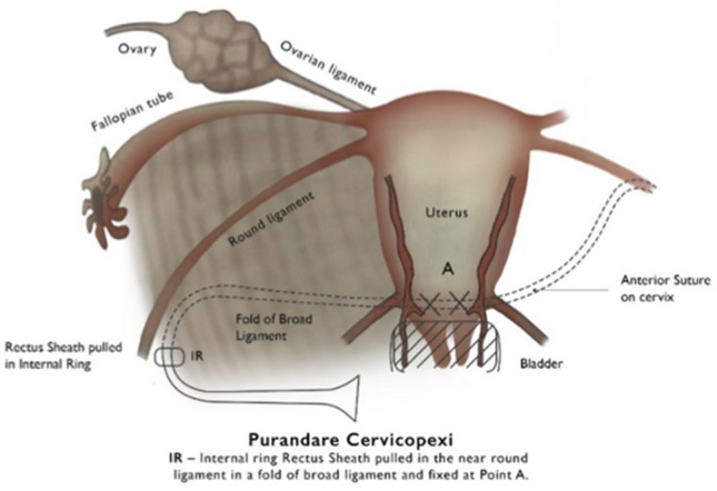 Fig. 3