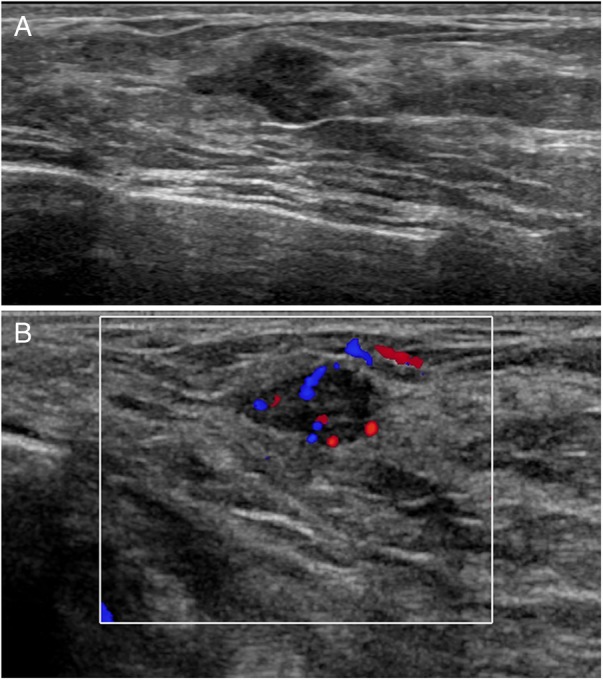 Figure 2