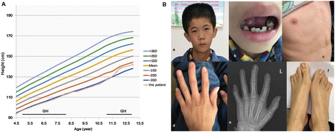 FIGURE 1