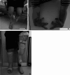Fig. 2
