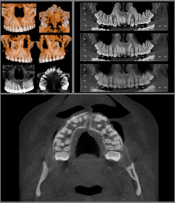 Figure 14: