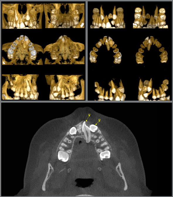 Figure 3: