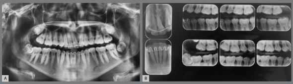 Figure 9: