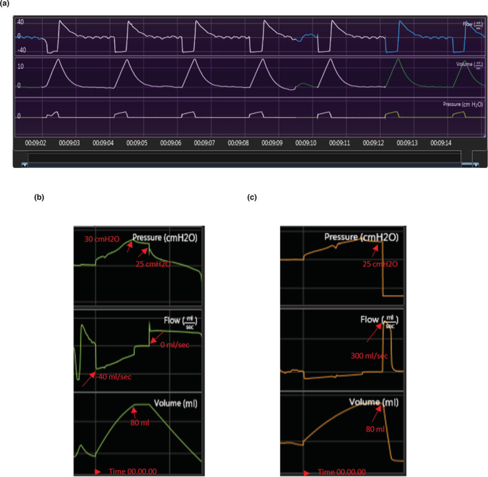 FIGURE 2