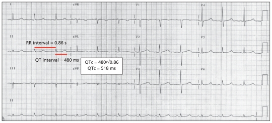 Figure 1: