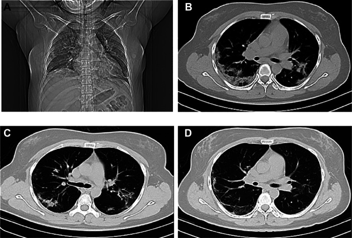 FIGURE 2