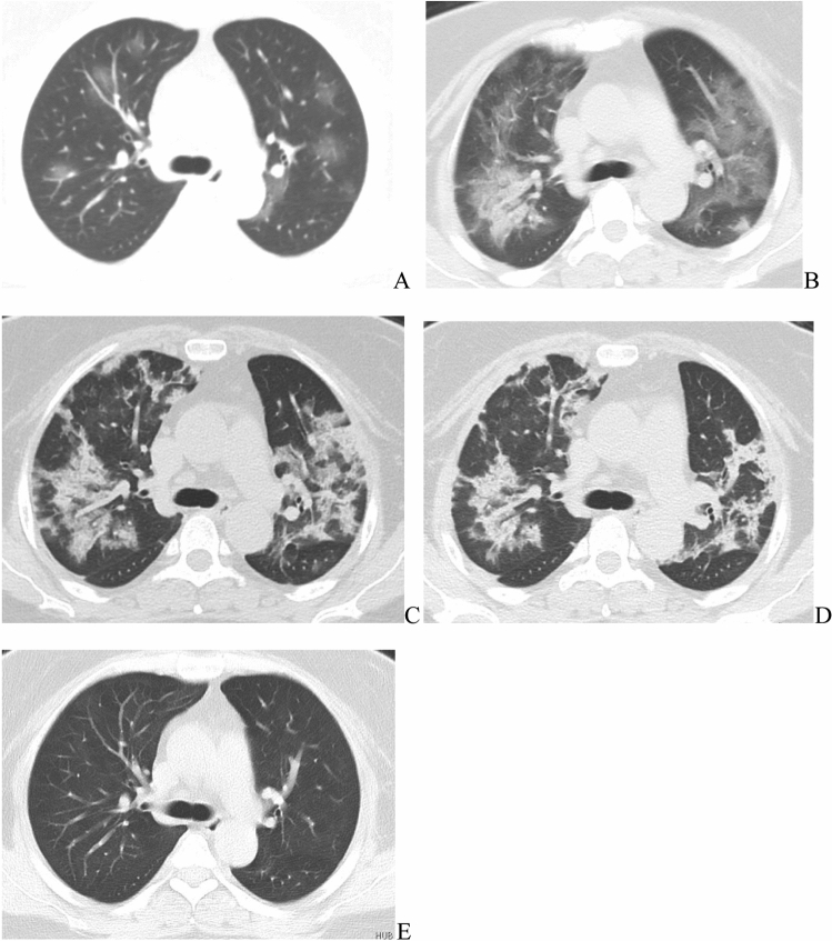 Fig. 1