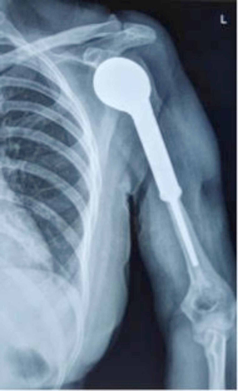 Figure 11
