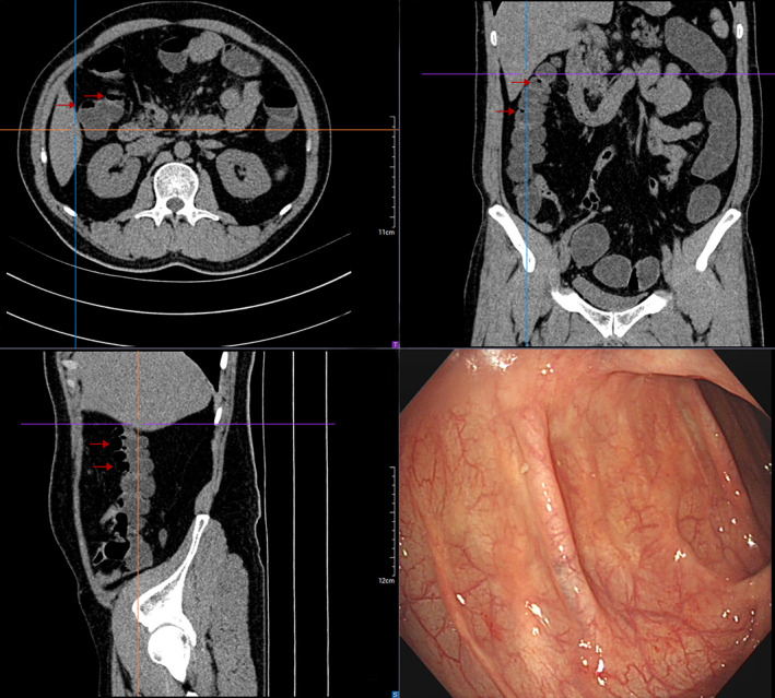 FIGURE 3