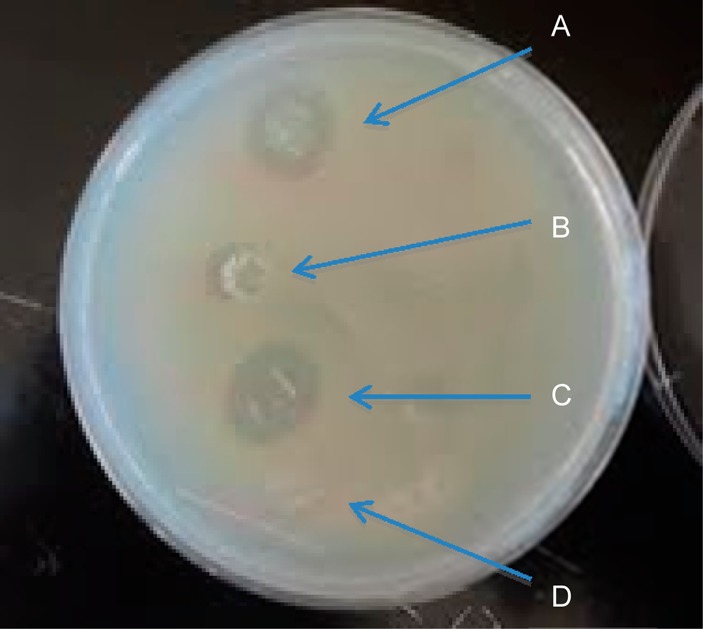 Figure 14