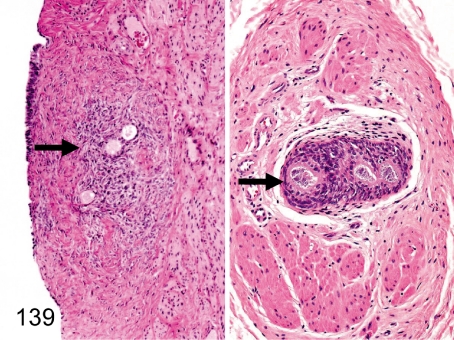 Fig. 139.