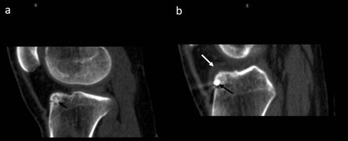 Figure 11.