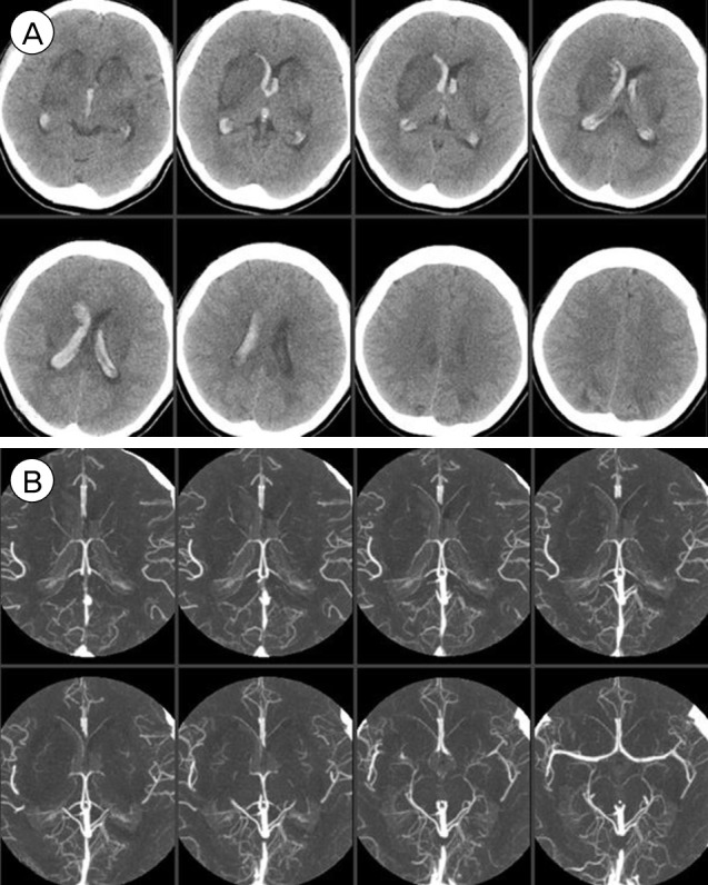 Fig. 6