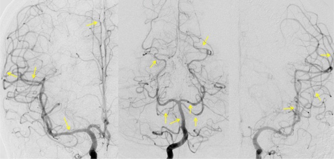 Fig. 4