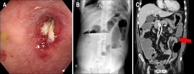 Fig. 1