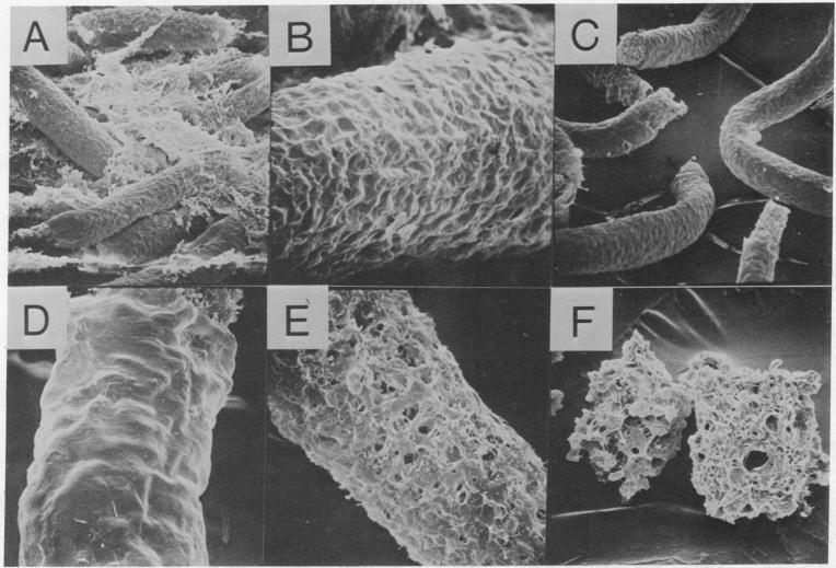 graphic file with name pnas00048-0197-a.jpg