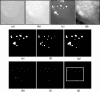 Fig 11