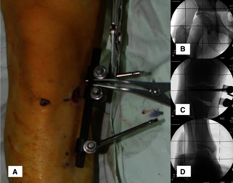 Fig. 5A–D