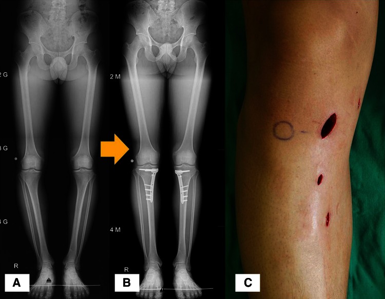 Fig. 7A–C