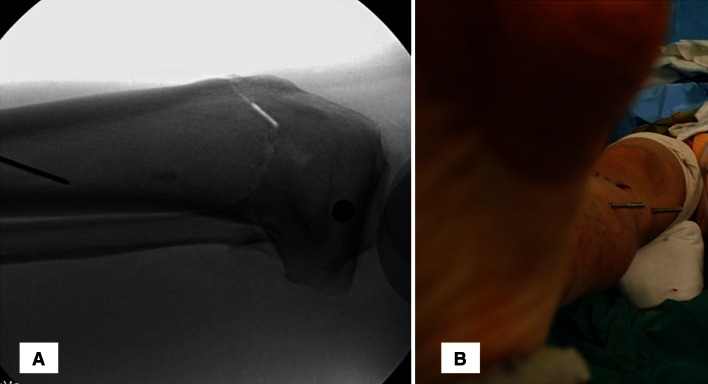 Fig. 4A–B