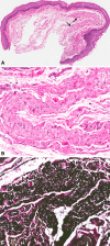 Fig. 1