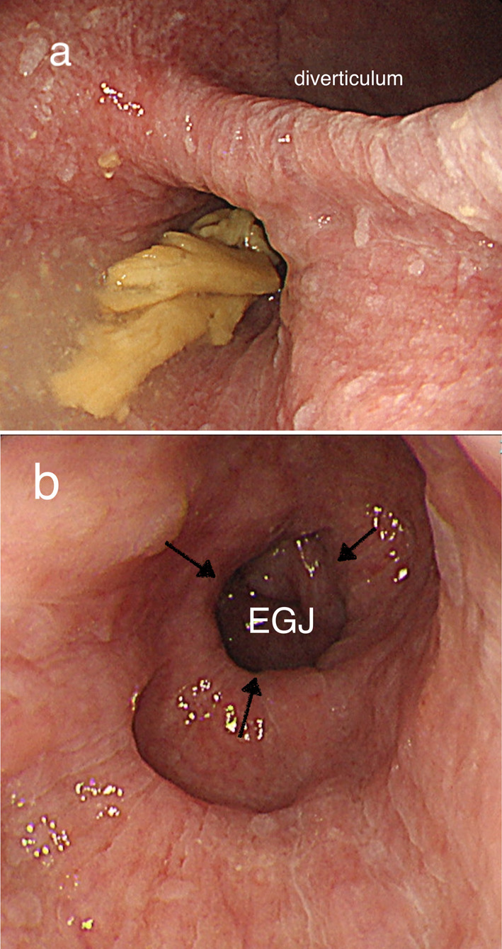 Fig. 1