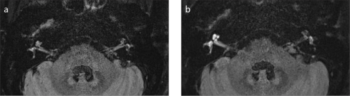 Figure 2. a, b