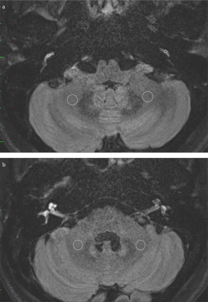 Figure 1. a, b