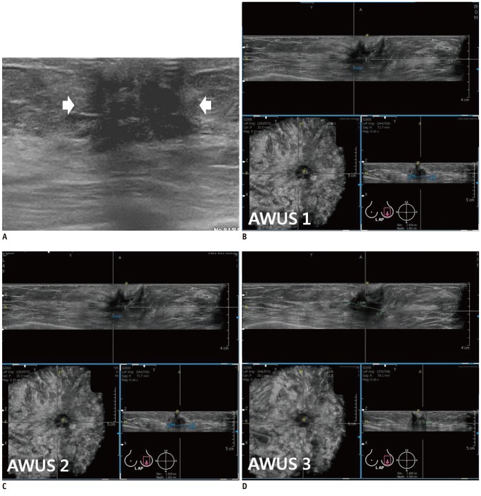 Fig. 3