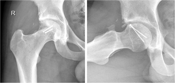 Fig. 7