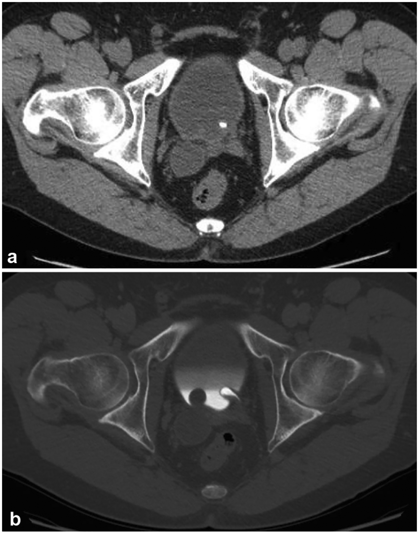 Fig. 11