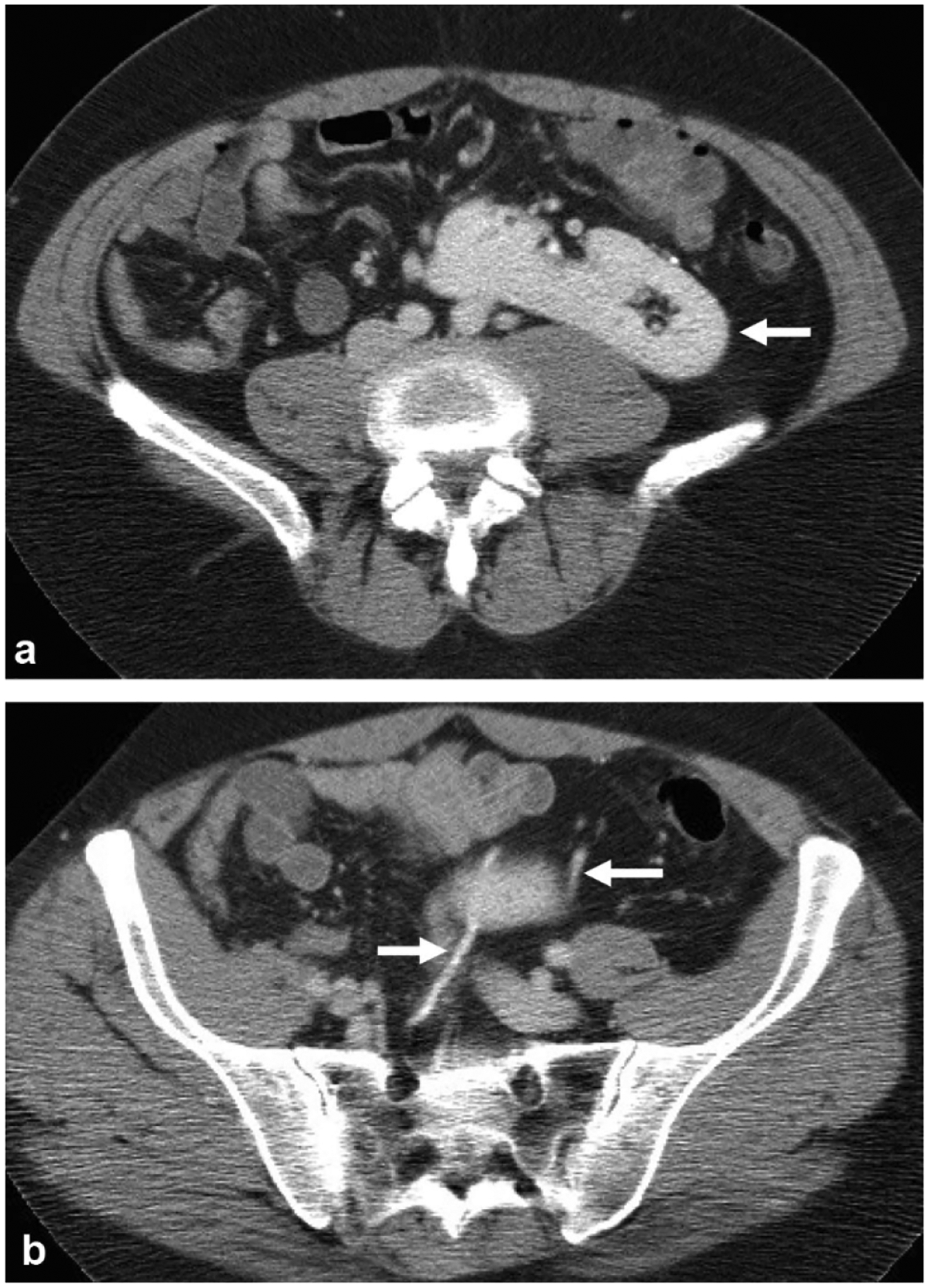 Fig. 14