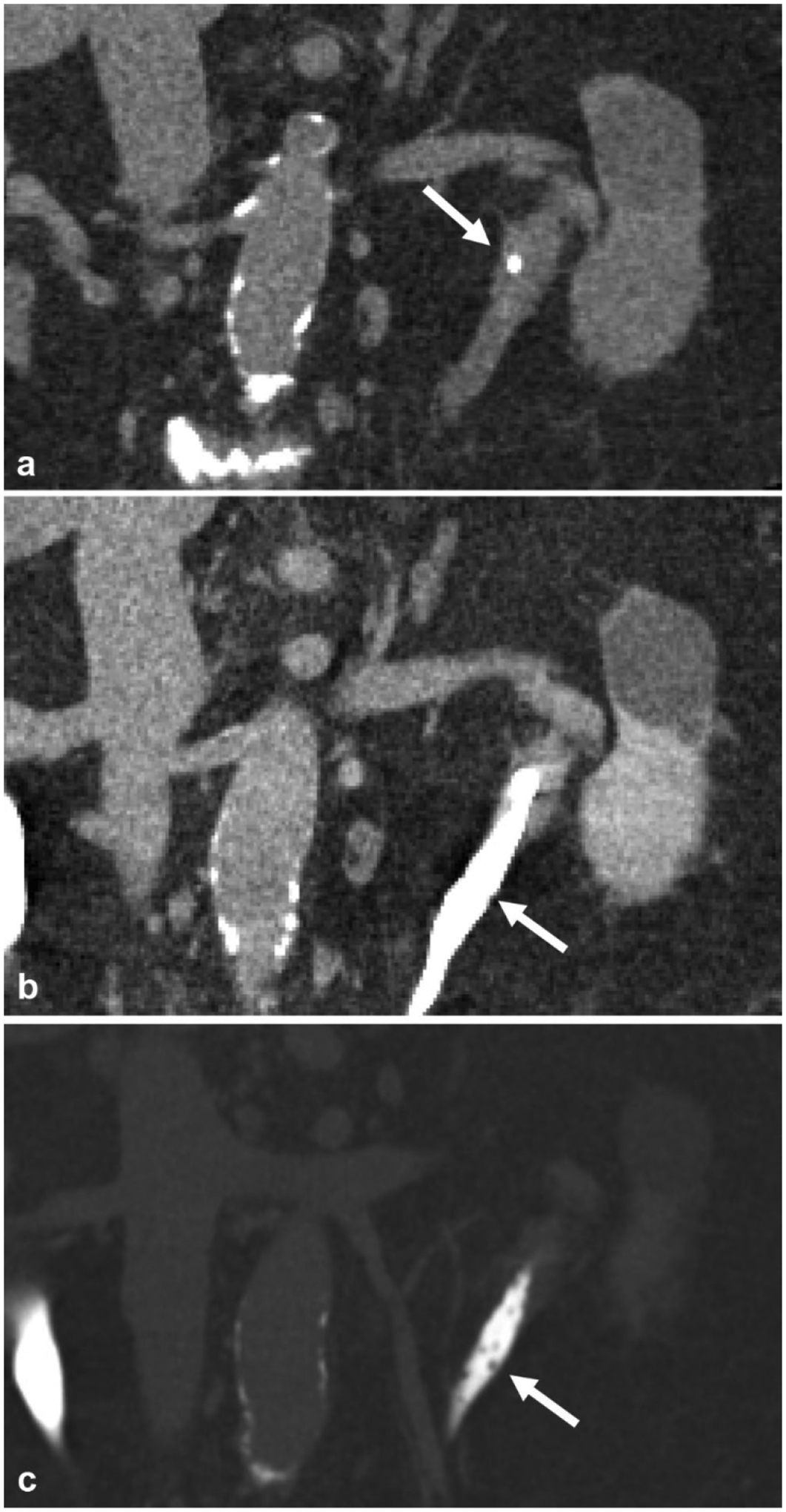 Fig. 15