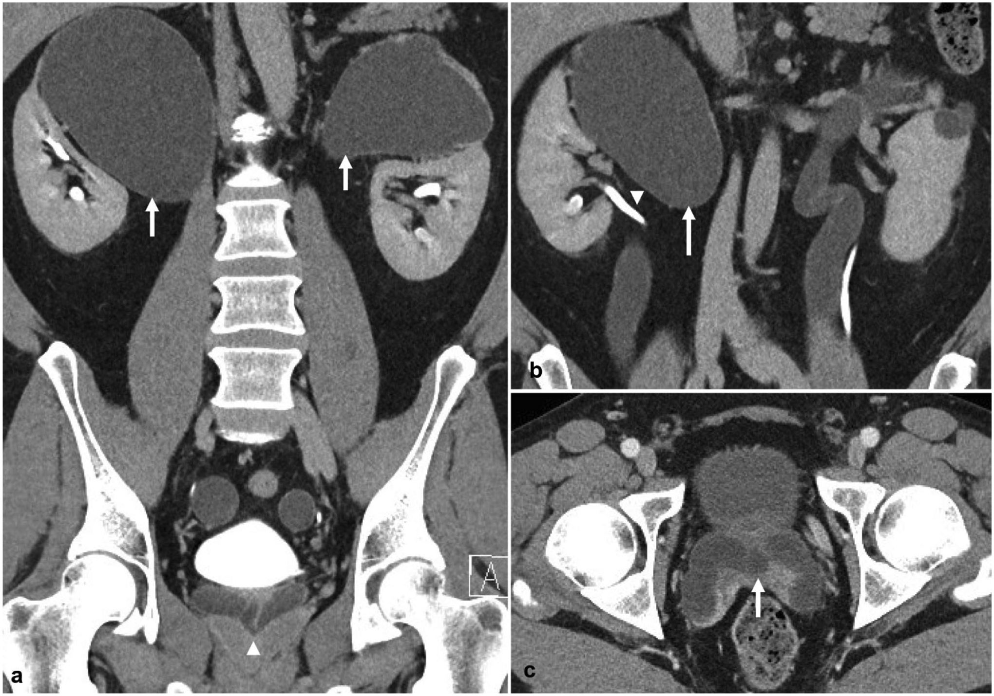 Fig. 13