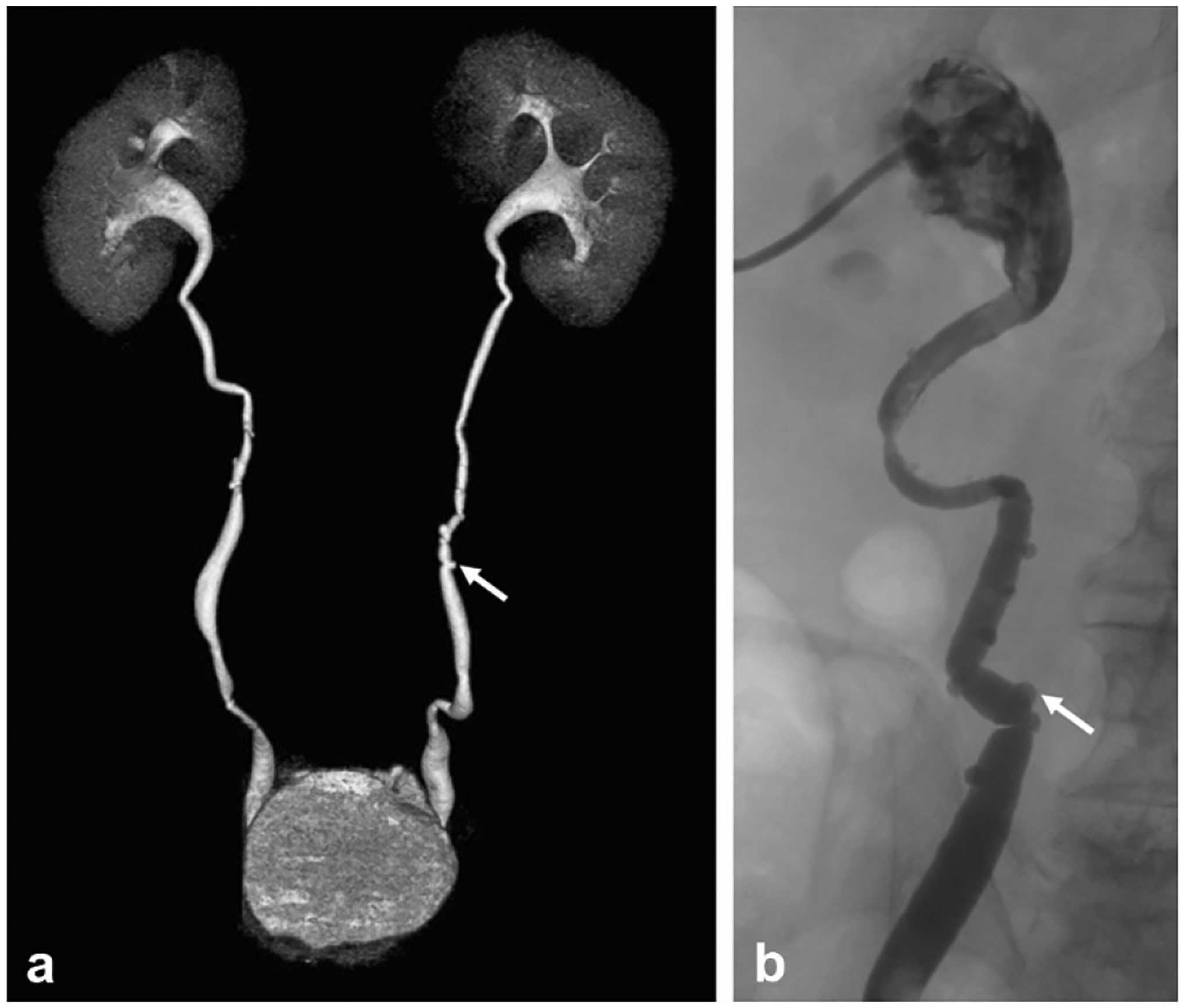 Fig. 16