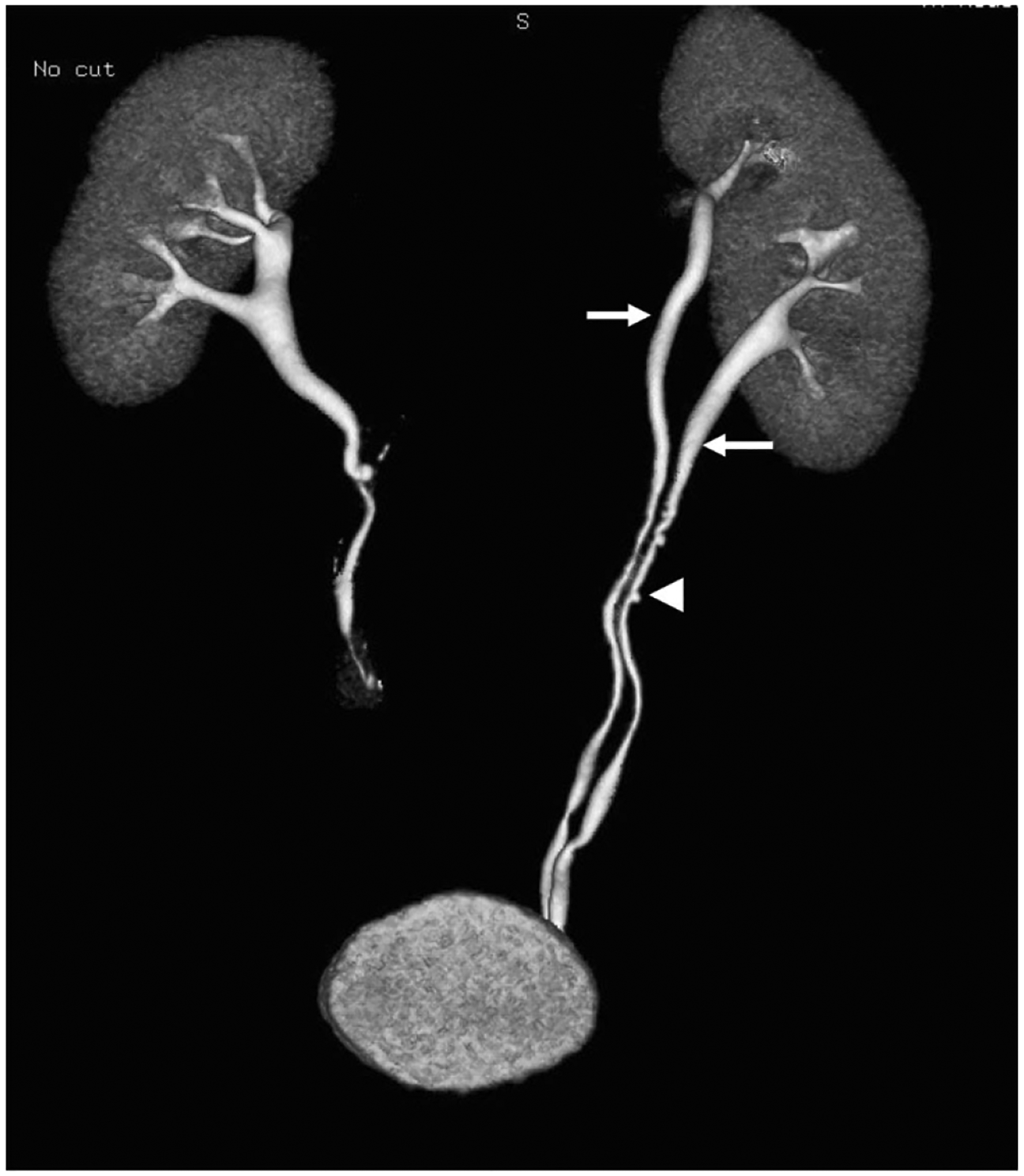 Fig. 12