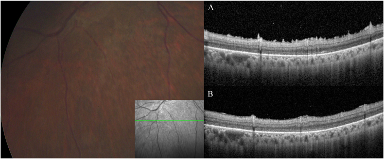 Fig. 3