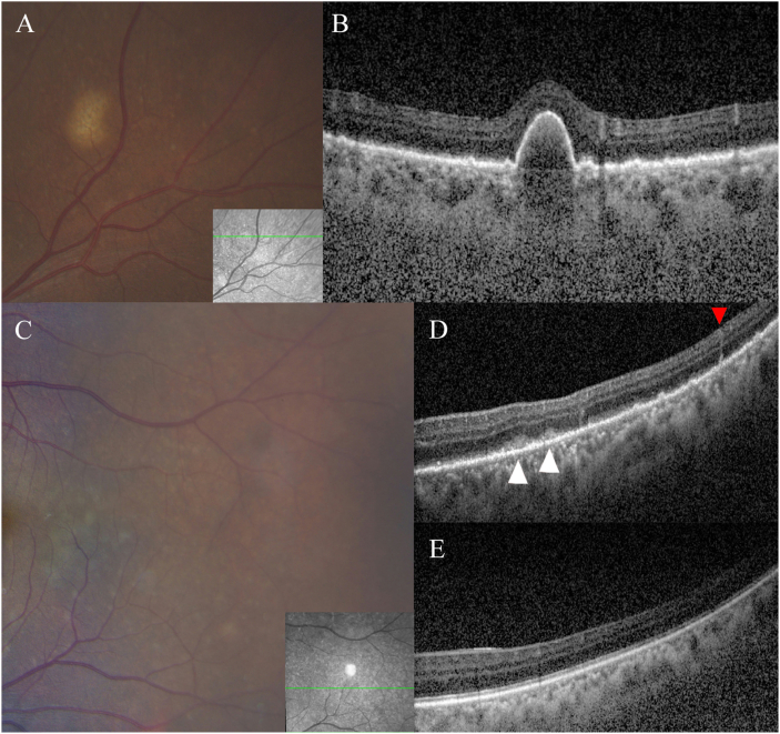 Fig. 2