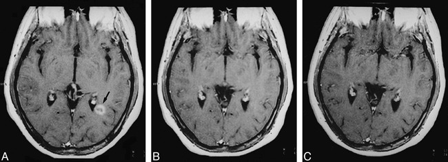 fig 3.