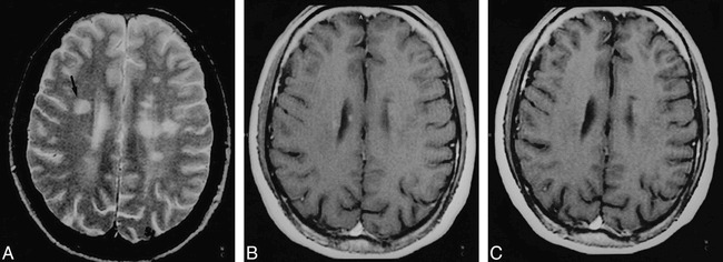 fig 2.