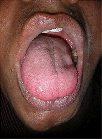 Fig. 3