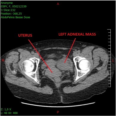 Fig. 1